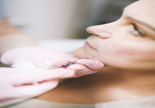 Hoe verlicht je hooikoortsklachten en welke middelen werken echt